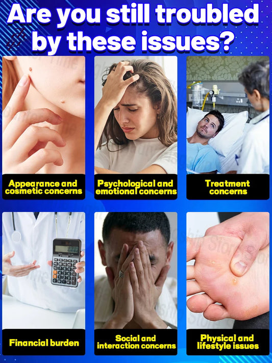Bestselling  ᵇˡᵘᵉ ˡⁱᵍʰᵗ ᵖᵉⁿ ᶠᵒʳ ʷᵃʳᵗ ʳᵉᵐᵒᵛᵃ and treatment, latest 2025 model