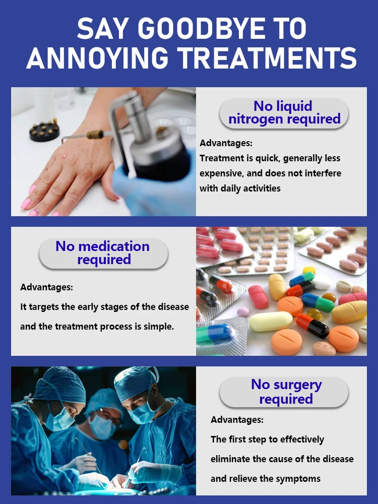 Bestselling  ᵇˡᵘᵉ ˡⁱᵍʰᵗ ᵖᵉⁿ ᶠᵒʳ ʷᵃʳᵗ ʳᵉᵐᵒᵛᵃ and treatment, latest 2025 model